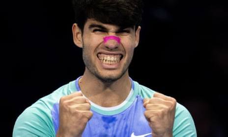 Why Carlos Alcaraz Wears Nasal Strips on Court