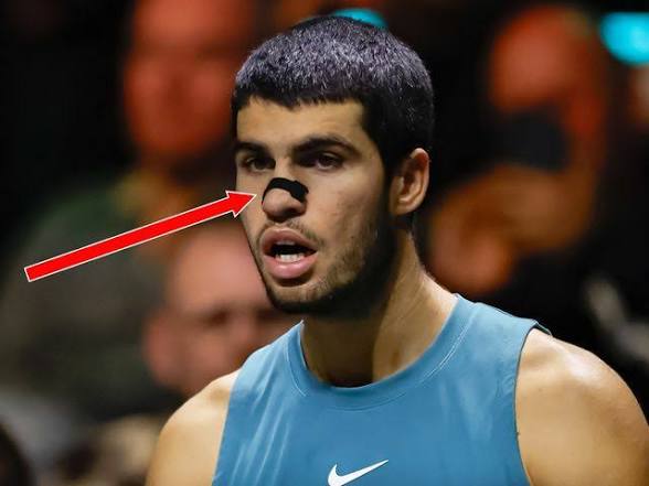 Do Nasal Strips Actually Work? What Athletes Know That You Don't